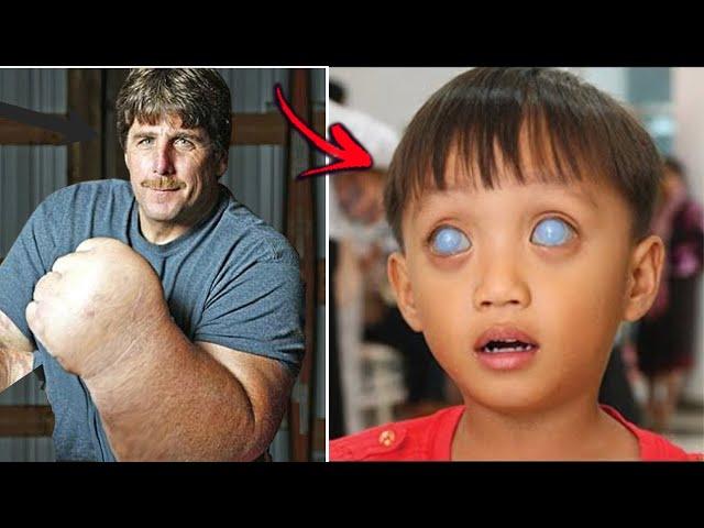 10 Amazing & Unique People Who Shock The World