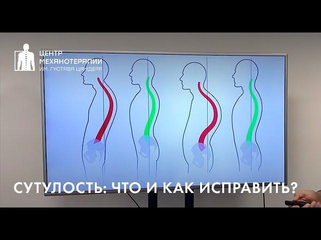 Сутулость и гиперкифоз: что это? причины? как исправить?