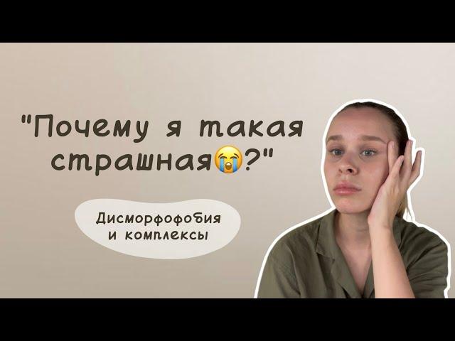 Комплекс некрасивости | Что делать, если не нравится своя внешность? | Дисморфофобия | Принятие себя