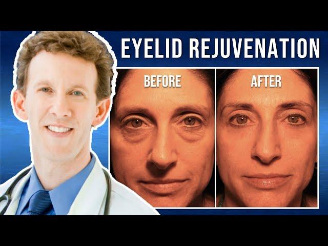 Laser Skin Resurfacing with Dr. Adam Scheiner | Kara's 5 Month Update