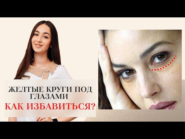 ЖЕЛТЫЕ КРУГИ ПОД ГЛАЗА   КАК ИЗБАВИТЬСЯ ОТ КРУГОВ ПОД ГЛАЗАМИ⁉️