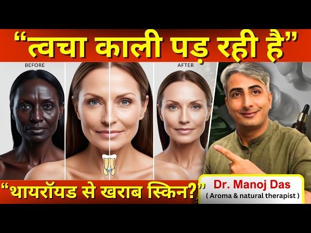 थायरॉयड से खराब स्किन? झुर्रियां आने से कैसे बचें? DR. MANOJ DAS I #drmanojdas