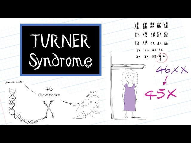 What is Turner Syndrome? (HealthSketch)