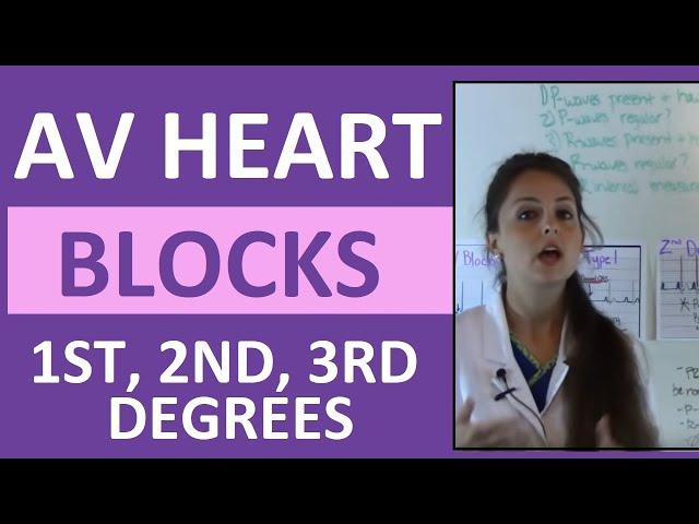 How to Interpret AV Heart Blocks Ekg Heart Rhythms | 1st degree, 2nd degree, 3rd degree difference