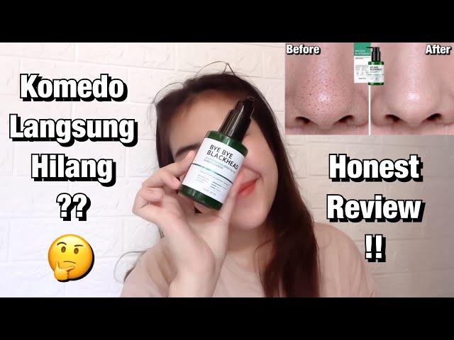 Cara Menghilangkan Komedo | Some By Mi  Bye Bye Blackhead Review