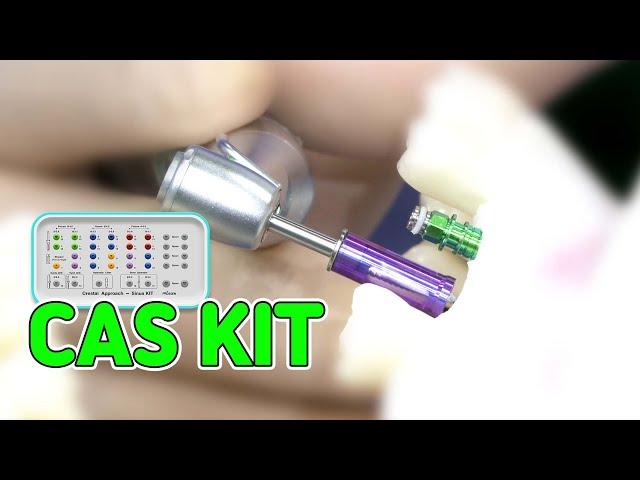 [EASY Hands-on] CAS KIT - #25, #26 Implant installation Case