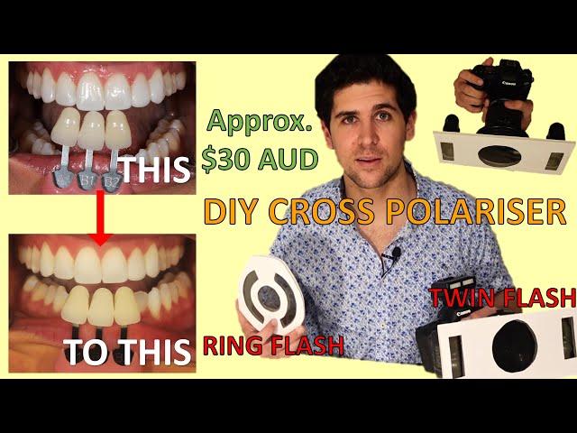 How To Make DIY Cross Polariser Filter At Home For Dental Photography (Ring Flash and Twin Flash)