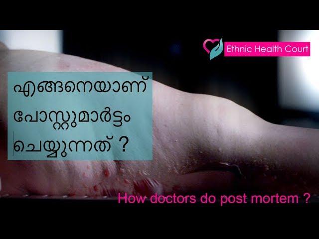 How doctors do post mortem ? | ഡോകടർ എങ്ങനെയാണ് പോസ്റ്റുമാർട്ടം ചെയ്യുന്നത് ? | Ethnic Health Court