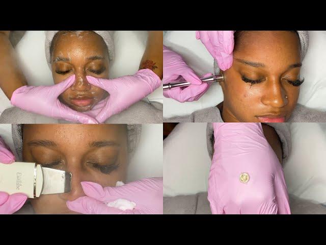 Summer Glow Facial w/ Microdermabrasion | GlamByLiaLeigh