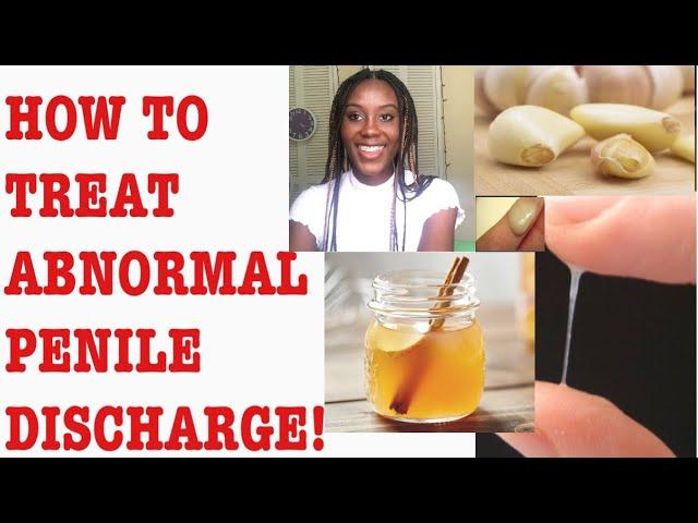 Home Remedies for ABNORMAL Penile Discharge: D&N Medical Series