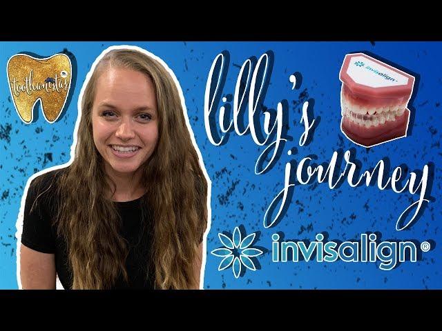 Lilly's Journey: 24 HOURS WITH INVISALIGN - Morning Routine