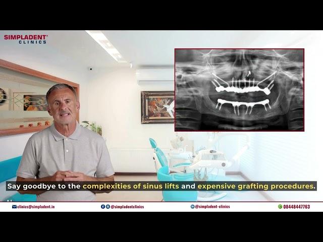 Dental Transformation at SimplaDent Clinic with Corticobasal Implants in 48 Hours #dentalimplants