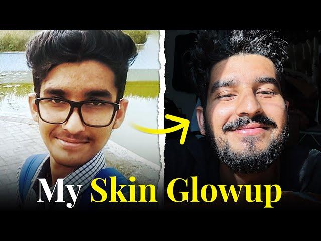 5 Minutes Skin Care Routine Every Man Needs!  | Simple and Affordable ️