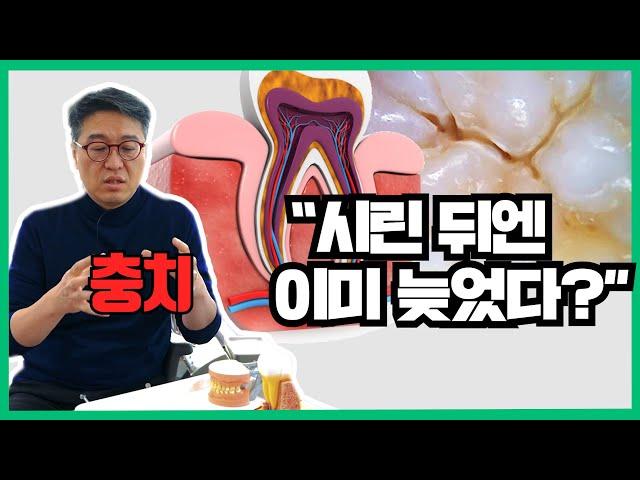 치과마다 충치 개수 다르게 알려주는 이유 / 신경치료 받기 싫으면 미리미리 가자 - [올쏘의 아싸  시즌1_Ep6]