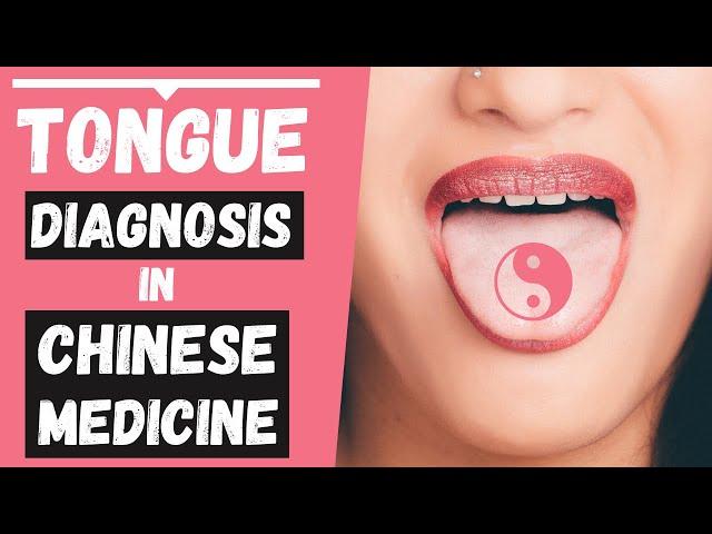 Tongue Diagnosis in TCM (made easy)