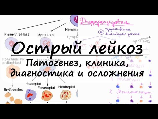 Острый лейкоз : патогенез, клинические проявления, гемограмма
