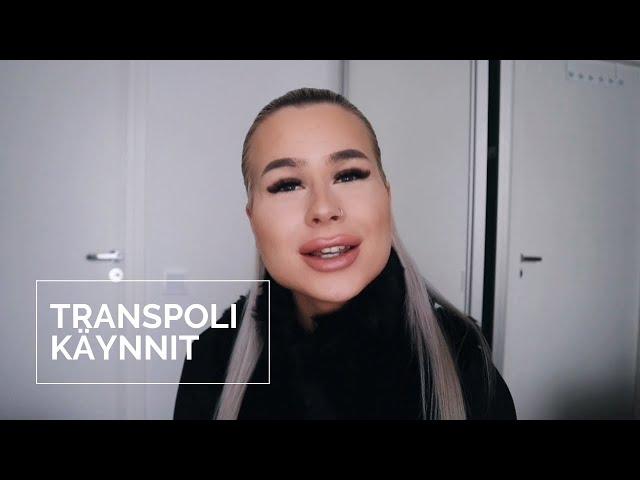 TRANSPOLI KÄYNNIT