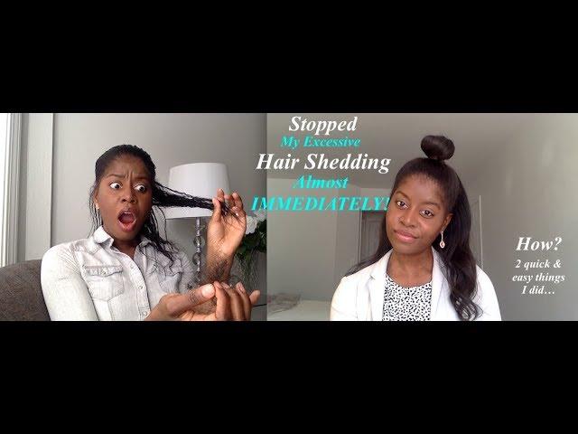 I Stopped Drastic Hair Shedding Almost IMMEDIATELY!