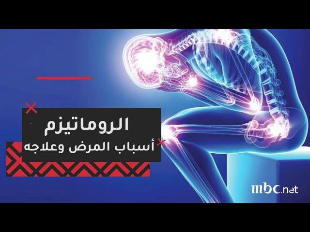 تعرف على أسباب "الروماتيزم" وعلاجه