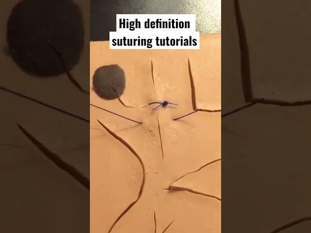 Simple interrupted suturing in HD 🩺 