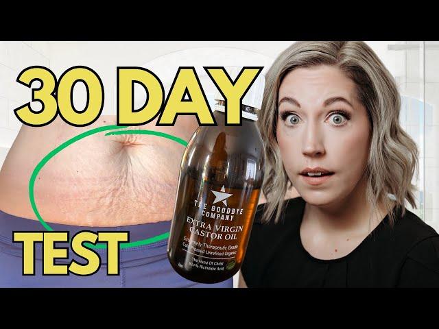  SHOCKING RESULTS?! Castor Oil on Stretch Marks? My 30 Day Test!!