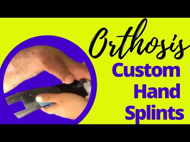 Custom Orthosis, Hand Braces and Complex Hand Splints | Hand Therapy Secrets