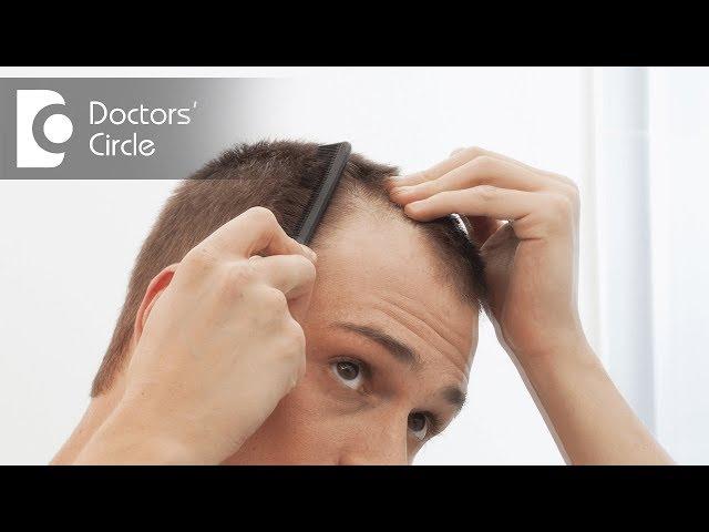 How to prevent premature male pattern baldness in young adults? - Dr. Aruna Prasad