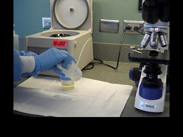 Preparing a Urine Specimen for Microscopic Examination