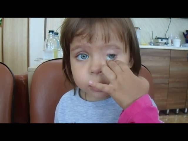 В 2 года дочка сама научилась вынимать глазной протез