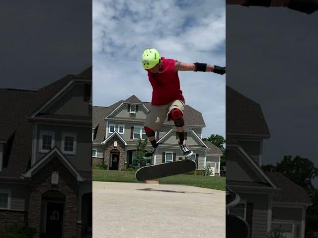 Post Surgery - Starting to land kickflips again! #shorts