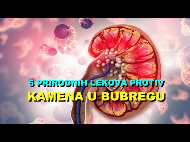 6 PRIRODNIH LEKOVA PROTIV KAMENA U BUBREGU