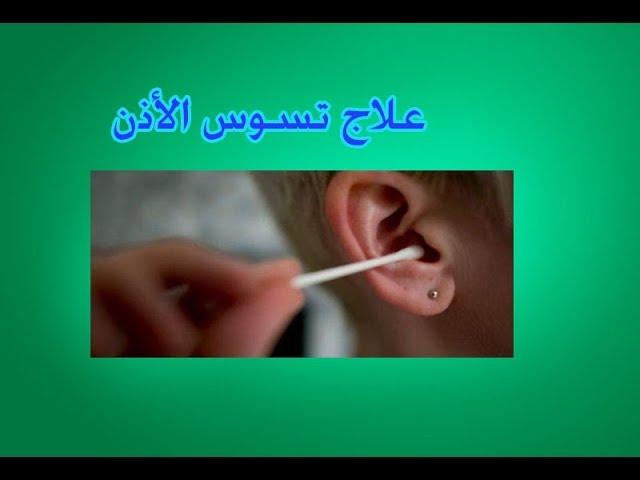 علاج تسوس الأذن