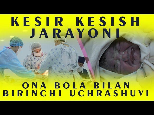 KESIR KESISH JARAYONI VA ONA BOLA BILAN BIRINCHI UCHRASHUVI КЕСИР КЕСИШ ЖАРАЁНИ #uzbekistan #kesir