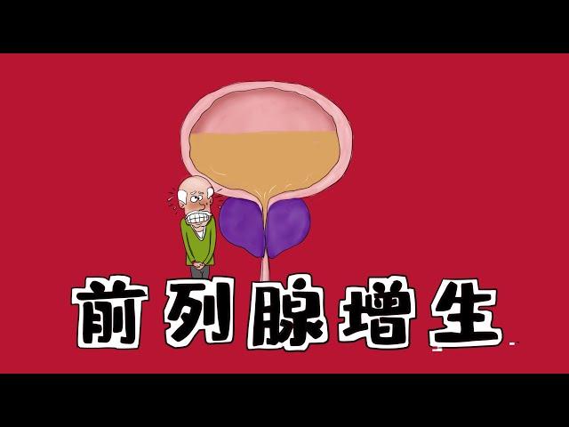 ＃医学手绘精讲 | 【良性前列腺增生】机制+症状+所有治疗（含中药）Medical hand drawing | [Benign prostatic hyperplasia]  BPH