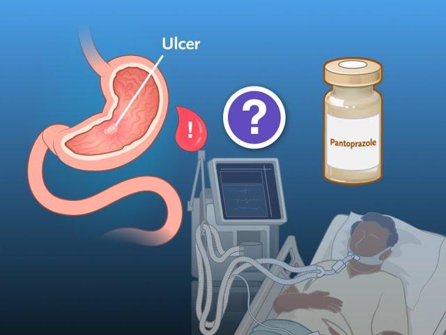 Ulcer Prophylaxis during Mechanical Ventilation | NEJM