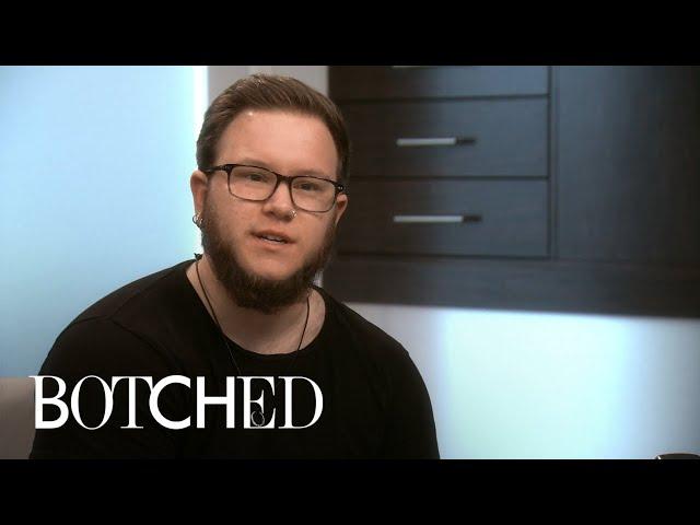 Transgender Man Wants to Fix His "Botched" Chest | E!