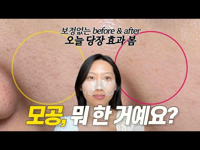 7년차 홈케어 전문가가 알려주는 모공 줄이는 법‍️  10분만에 깐달걀되는 꿀팁 대방출