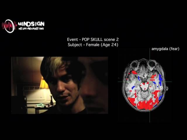 Pop Skull Second Brain Scan Movie