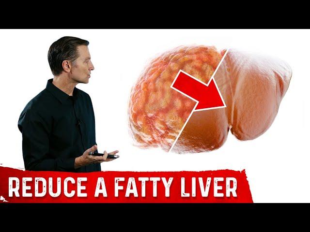 The Best Fatty Liver Exercise – Treatment of Fatty Liver – Dr.Berg