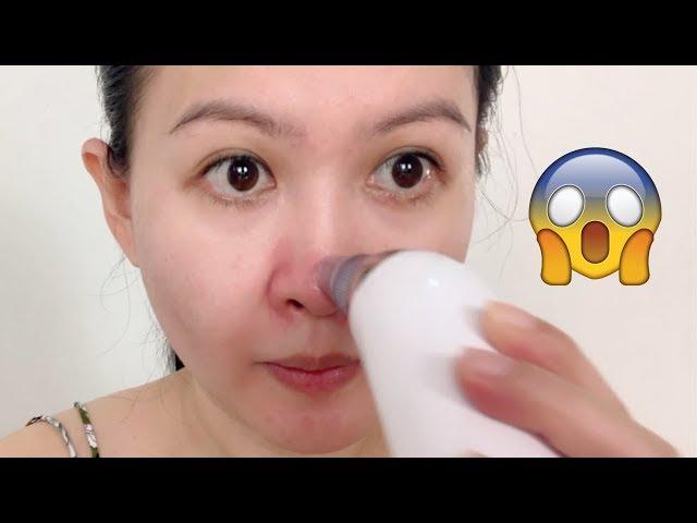 How To Use Blackhead Vacuum Suction Machine