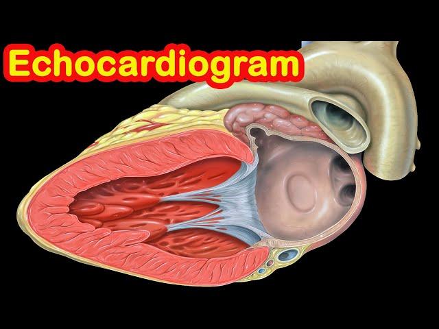 Echocardiogram