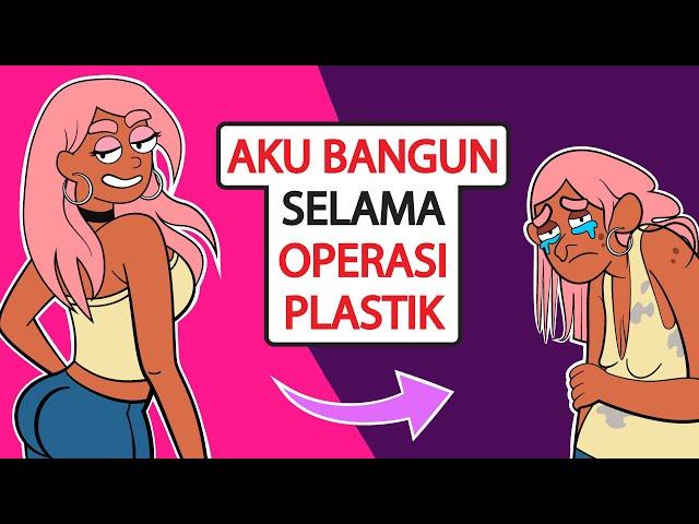 AKU MELAKUKAN KESALAHAN FATAL TERBANGUN SELAMA OPERASI PLASTIK...  | KISAH DIRIKU