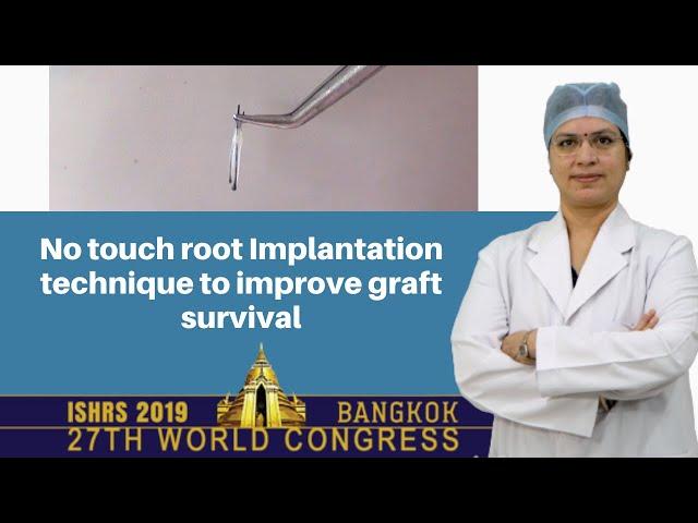 No Touch Root Implantation Technique To Improve Graft Survival  | Dr. Seema Garg