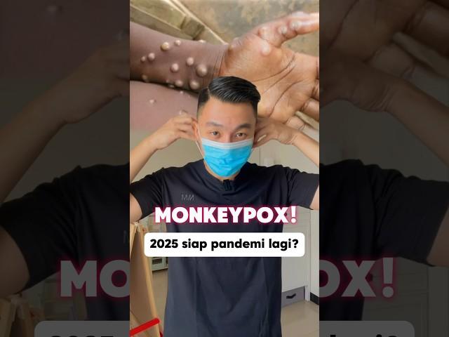 Apa itu penyakit monkeypox? 5 fakta penyakit mpox cacar monyet di Indonesia! #mpox #monkeypox