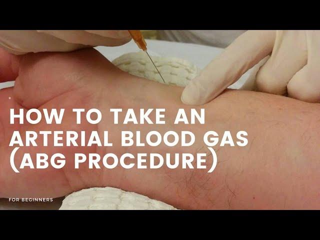 How to take blood for ABG (Arterial blood gas)