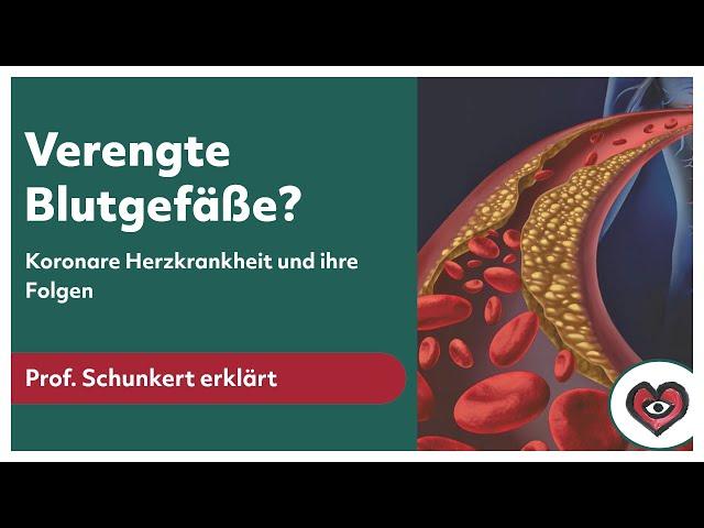 Verengte Blutgefäße? Koronare Herzkrankheit und ihre Folgen