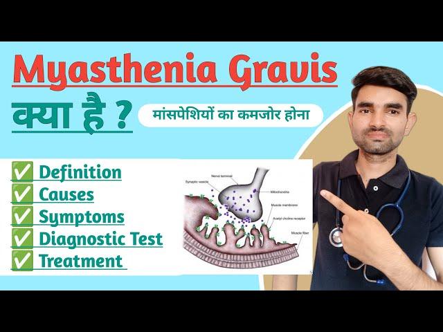 Myasthenia Gravis in Hindi | Causes, Symptoms And Treatment of Myasthenia Gravis