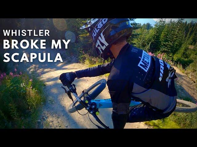 The Most Painful Crash of my life | Whistler Bike Park Accident