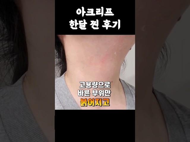 아크리프 사용후기 #디페린 #스티바a #스티바에이 #안티에이징 #바세린 #아크리프