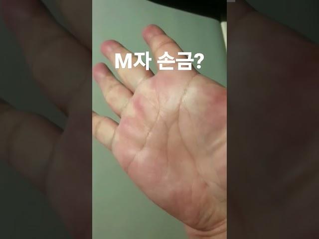 저 M자 손금인가요? 부자 될 수 있나요?